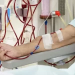 Hemodialysis